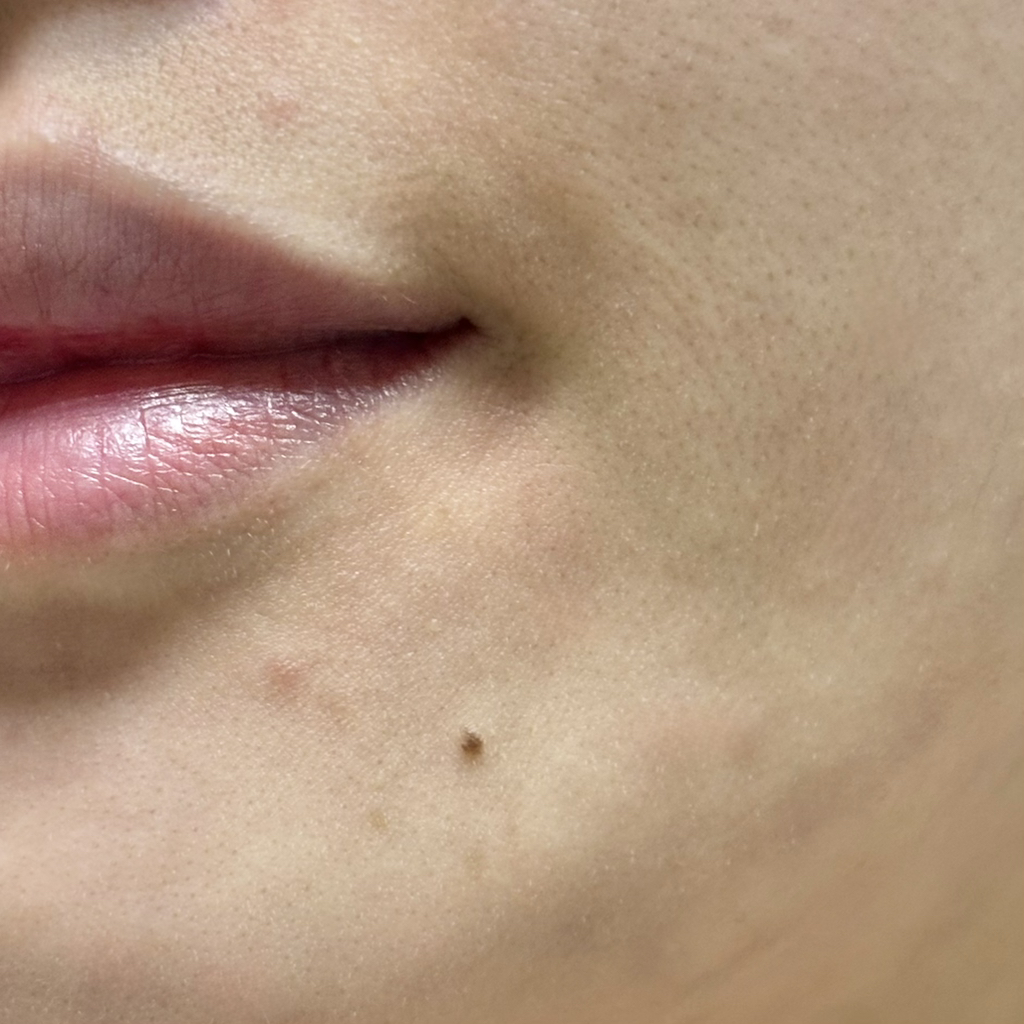 펠드아포테케 (Feldapotheke) 피토 캄 세럼 review image