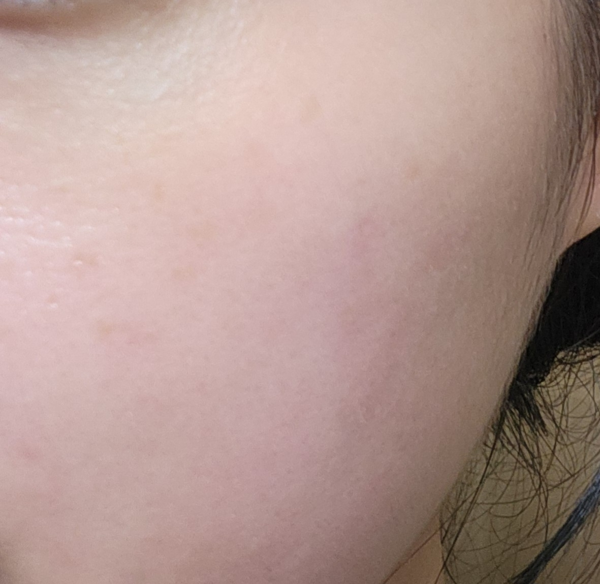 앰플엔 (AMPLE:N) 센텔카밍샷 앰플 review image