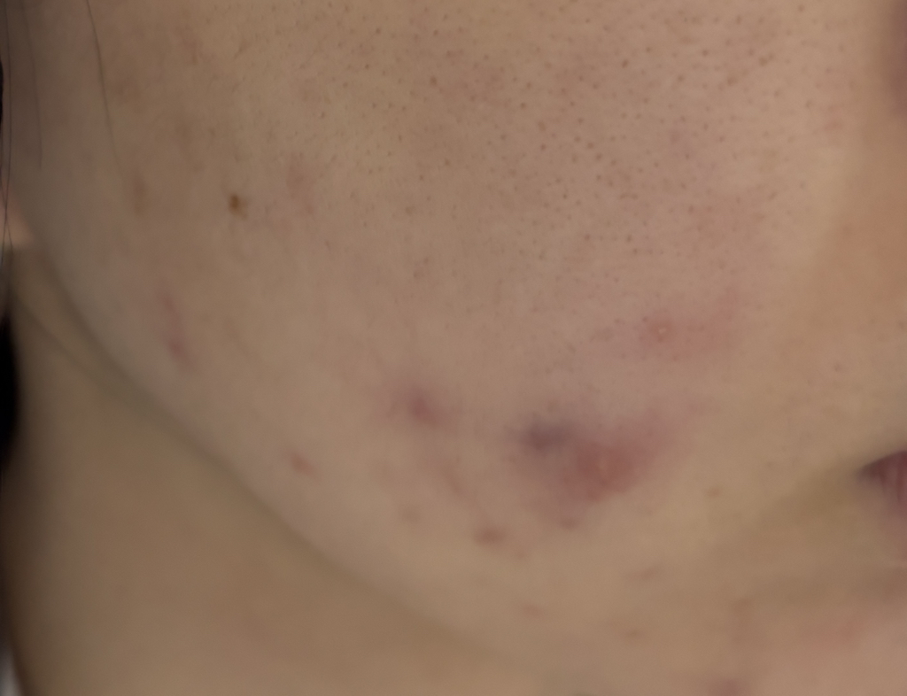 珀塞尔 20 亿/毫升 PixelBiome™ 浓缩液 review image