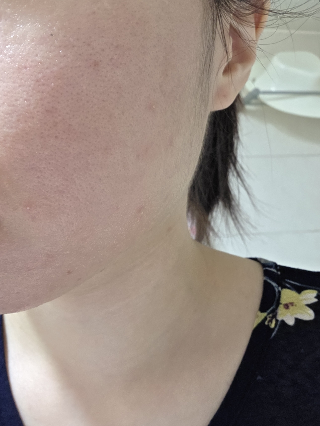 后莉美 Sunrice 日用泡沫洁面乳 common.review image