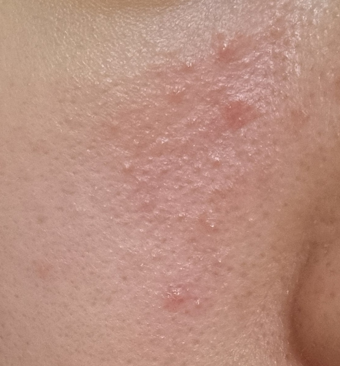 霏丝佳 Redsoothing AI 化妆水 common.review image