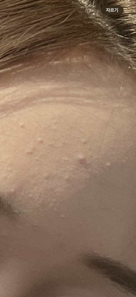 保湿精华露的真实用户使用照片