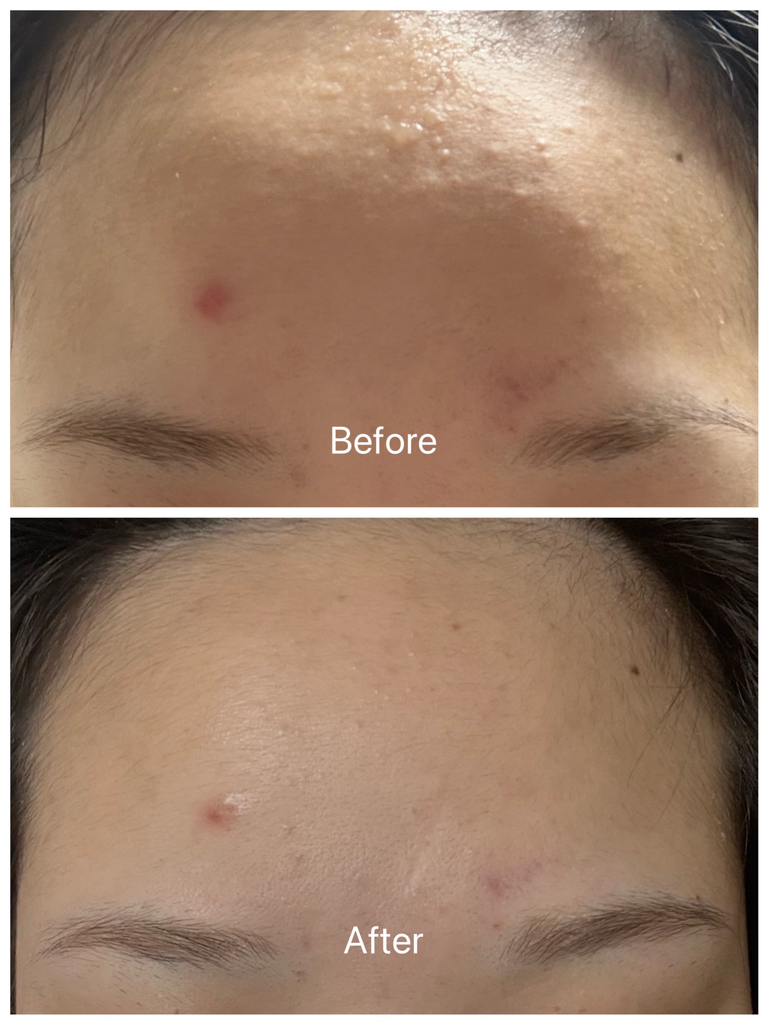 오어스 (O'earth) 히알루론시카 7초 세럼 인 앰플 review image