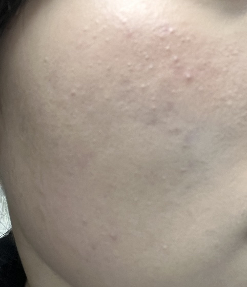 에르보리앙 (erborian) CC 레드 코렉트 [SPF25] review image