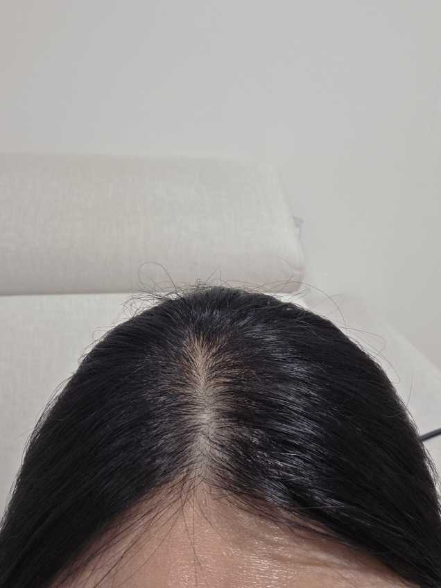 닥터포헤어 (Dr.FORHAIR) 폴리젠 씨크닝 스칼프 세럼 review image