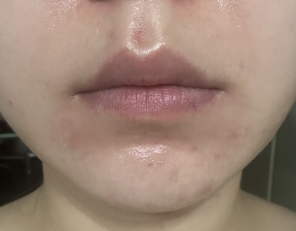 午夜蓝青少年激活水滴的真实用户使用照片