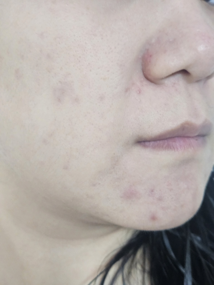 리얼베리어 (RealBarrier) 워터리 히알 크림 review image