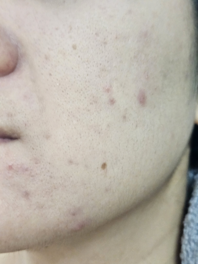 리얼베리어 (RealBarrier) 워터리 히알 크림 review image