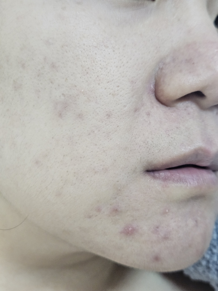 리얼베리어 (RealBarrier) 워터리 히알 크림 review image