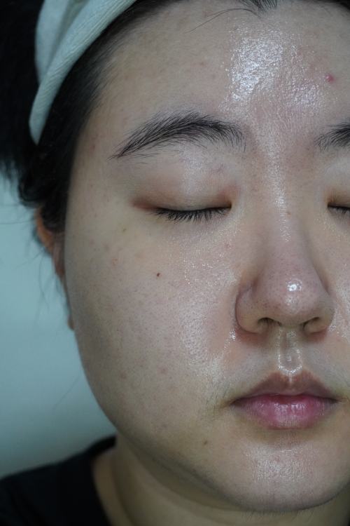 브이티코스메틱 (VTCOSMETICS) 피디알엔 글로우 앰플 review image