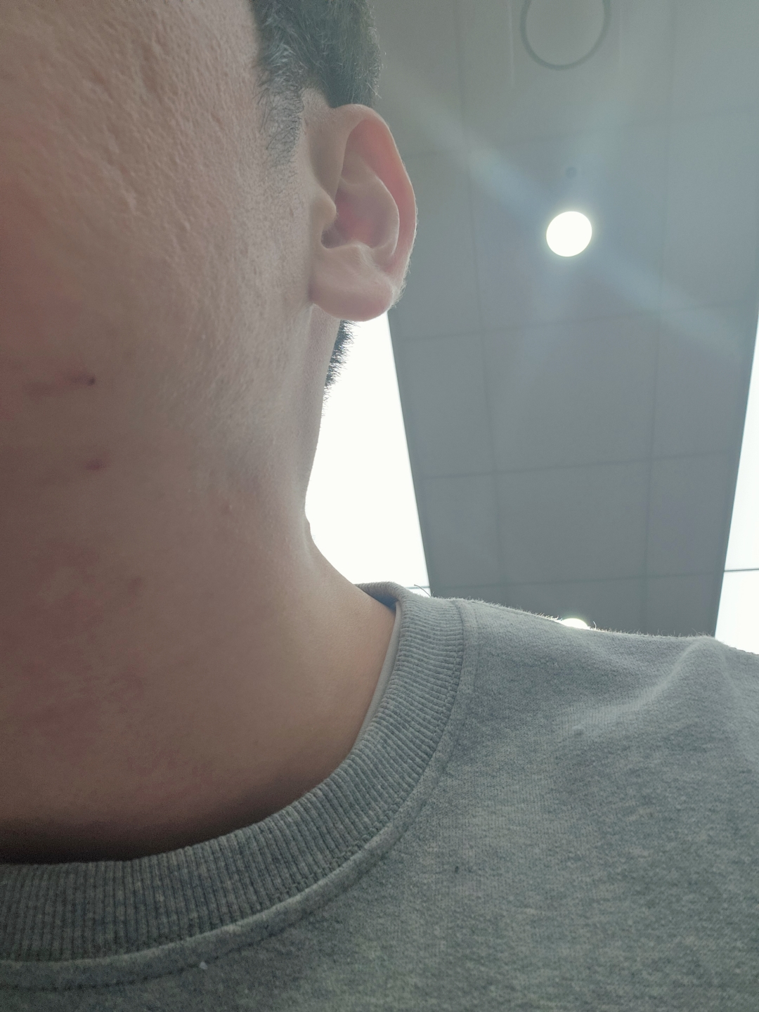 1025 独岛乳液的真实用户使用照片