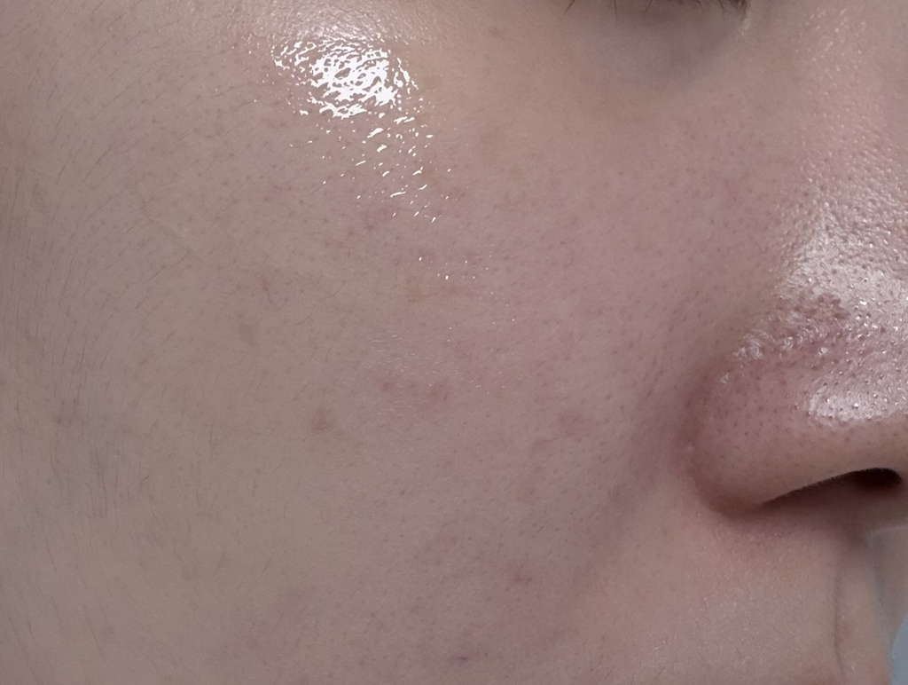 마미케어 (mommycare) 바다포도 모공앰플 review image