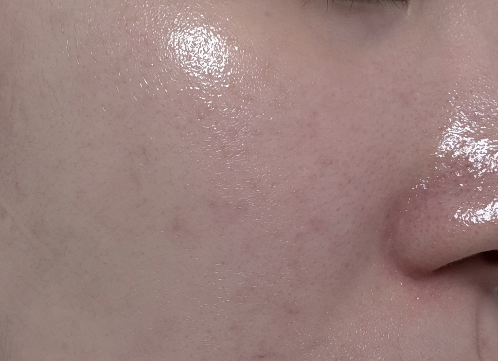 마미케어 (mommycare) 바다포도 모공앰플 review image