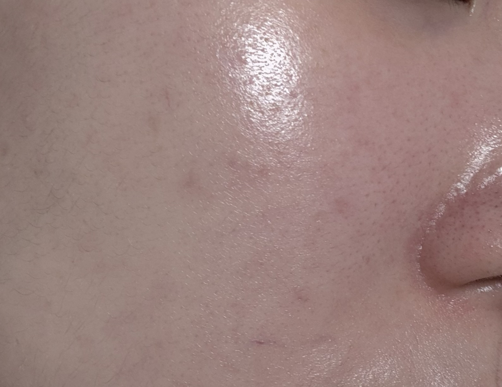 나인위시스 (9wishes) 하이드라 앰플Ⅱ review image