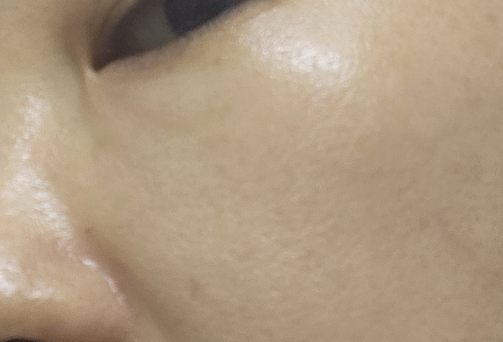 保湿医生乳霜的真实用户使用照片