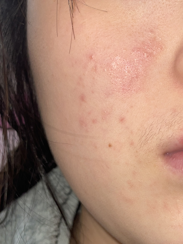 黄芩草泰卡胶囊精华镇静滴剂的真实用户使用照片