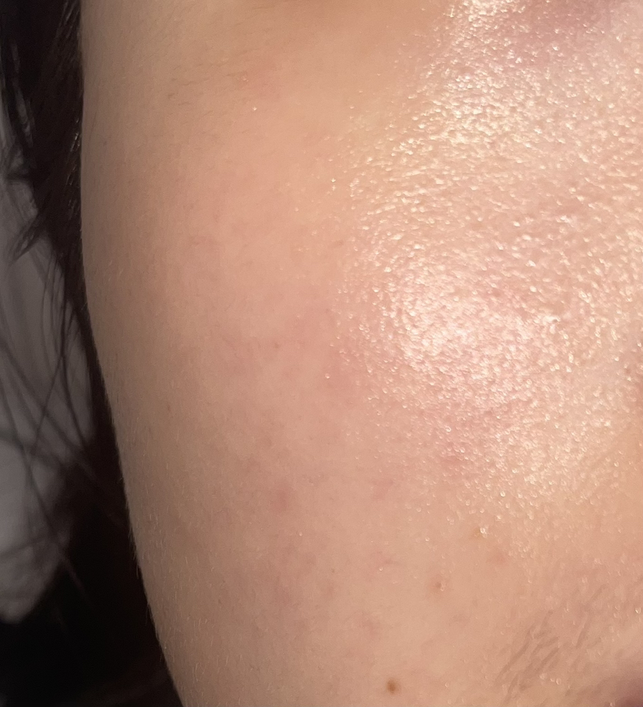 黄芩草泰卡胶囊精华镇静滴剂的真实用户使用照片