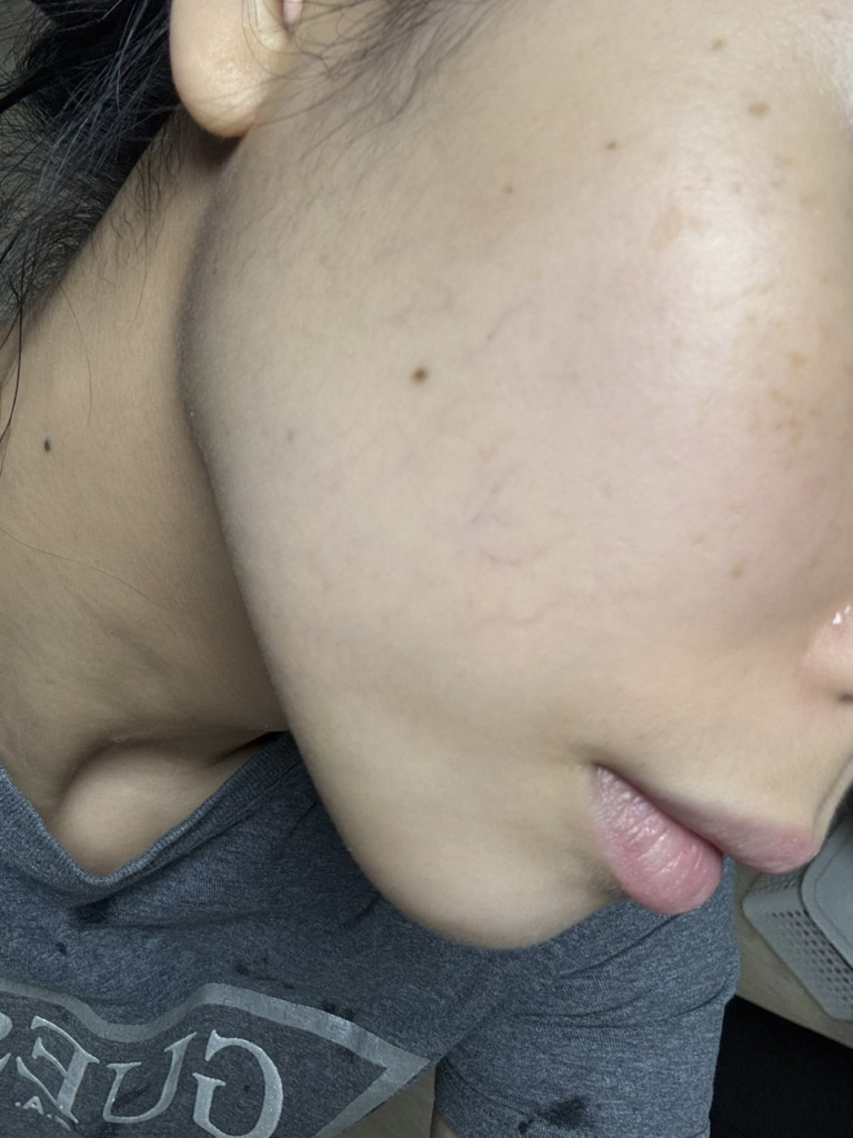 保湿精华露的真实用户使用照片