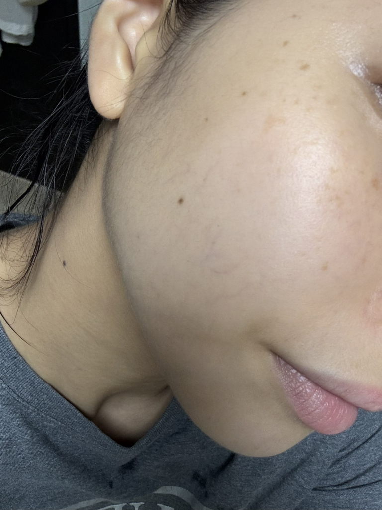 保湿精华露的真实用户使用照片