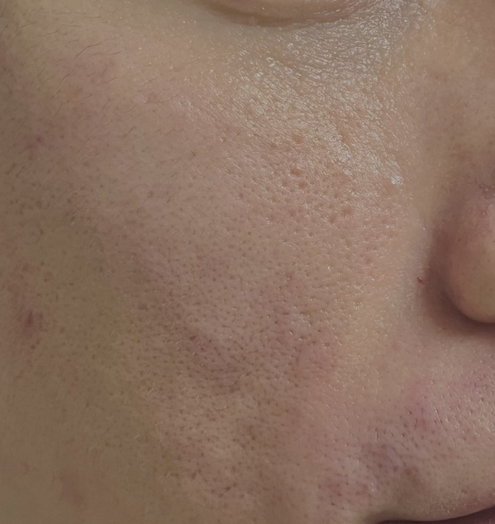 토리든 (Torriden) 밸런스풀 포맨 시카 프레쉬 올인원 review image