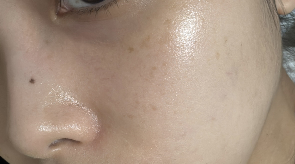 Ảnh đánh giá thực tế của người dùng về Bifida Serum Firming Drop