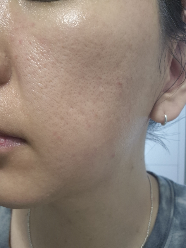 히디프 (hidiff) 로얄 소프트 클린키트 review image