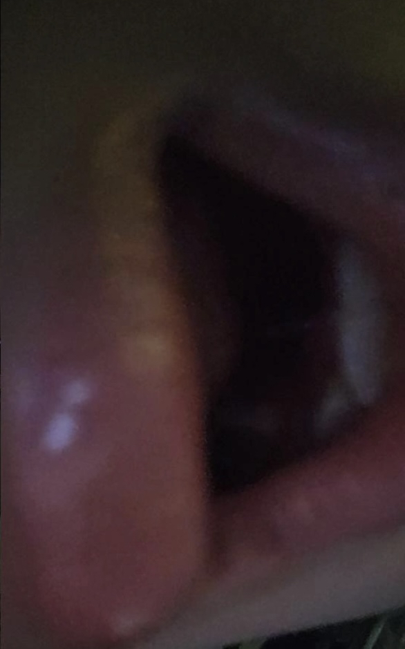 삐아 (BBIA) 너츠 시럽 에디션 오버 글레이즈 [06 땅콩당] review image