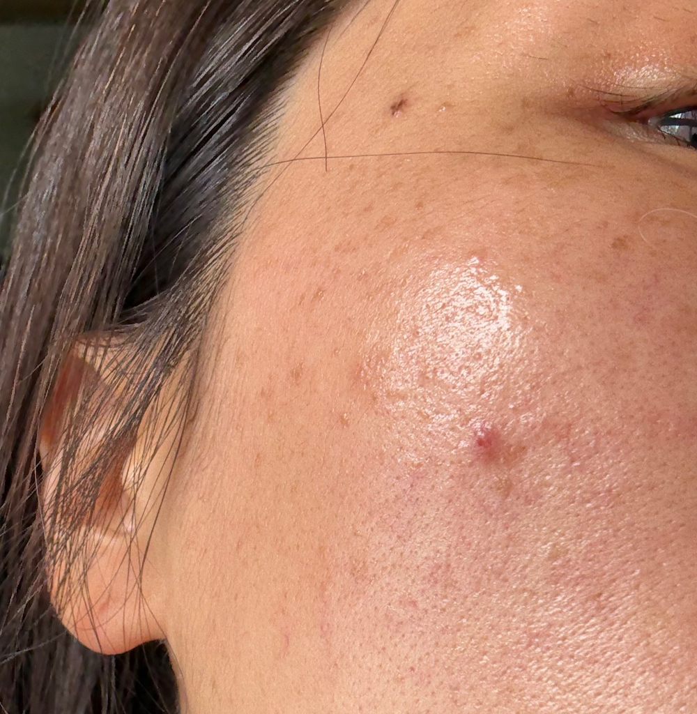 아워덤 (OURDERM) 피디알엔 컴플리트 인텐시브 크림 review image