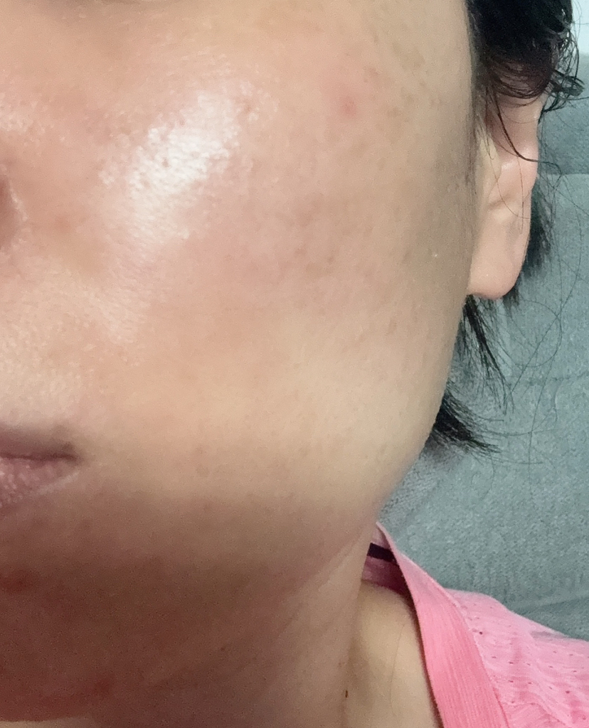 아워덤 (OURDERM) 피디알엔 컴플리트 인텐시브 크림 review image