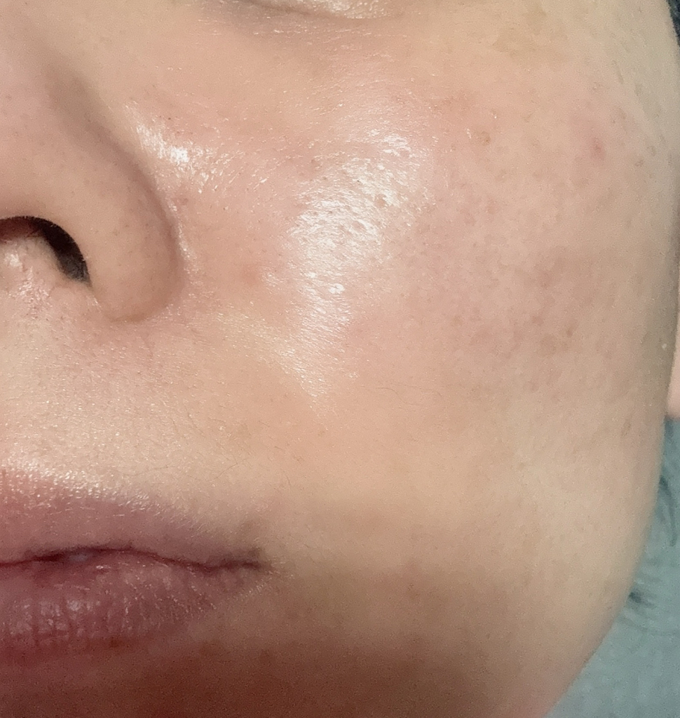 아워덤 (OURDERM) 피디알엔 컴플리트 인텐시브 크림 review image