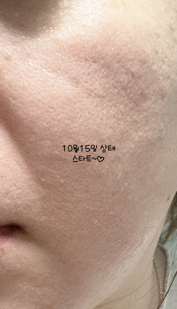 아워덤 (OURDERM) 피디알엔 컴플리트 인텐시브 크림 review image