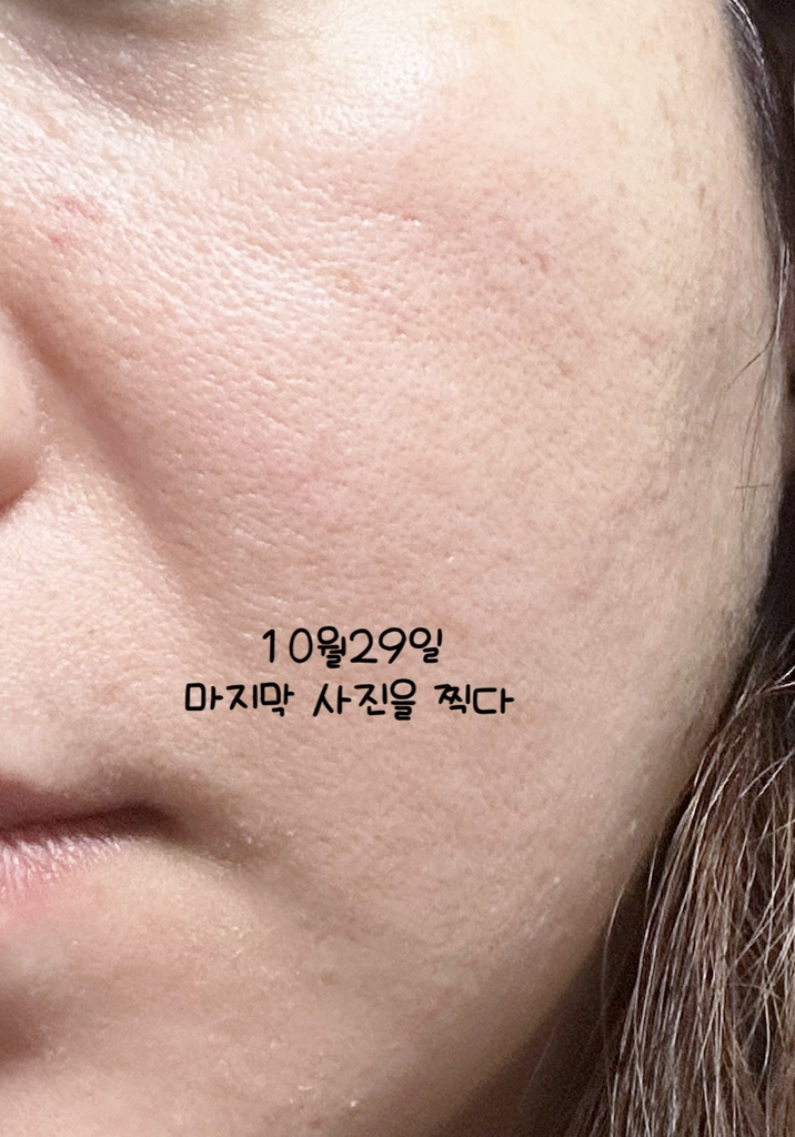 아워덤 (OURDERM) 피디알엔 컴플리트 인텐시브 크림 review image