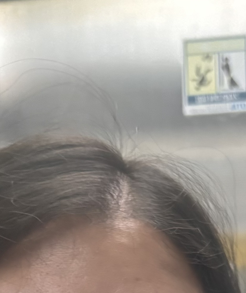 디피어 (DEEPEER) 24 미라클 노워시 헤어 트리트먼트 review image