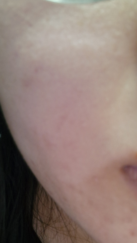 네시픽 (NACIFIC) 시카 피디알엔 카밍 세럼 review image