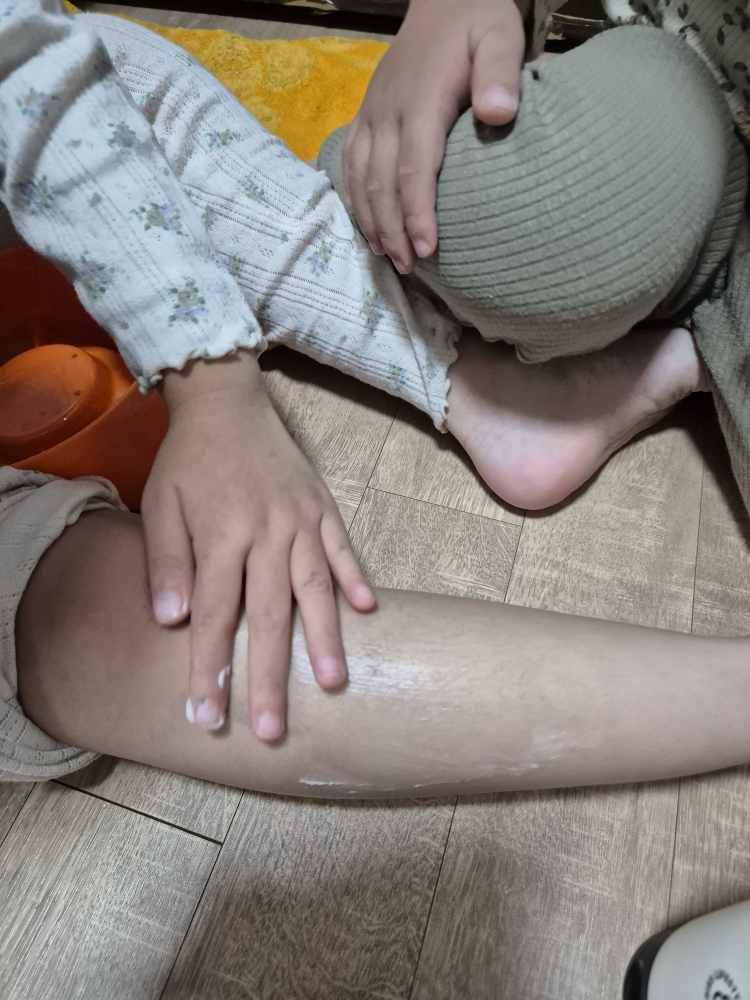 몽디에스 (mongdies) 아토 크림 review image