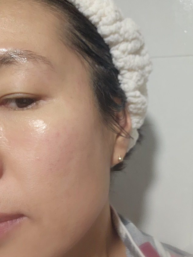 퓨어리카 (purelica) 퓨어 퍼펙션 마스크 review image