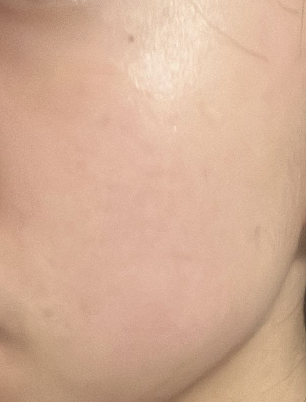 毛孔紧致垫的真实用户使用照片