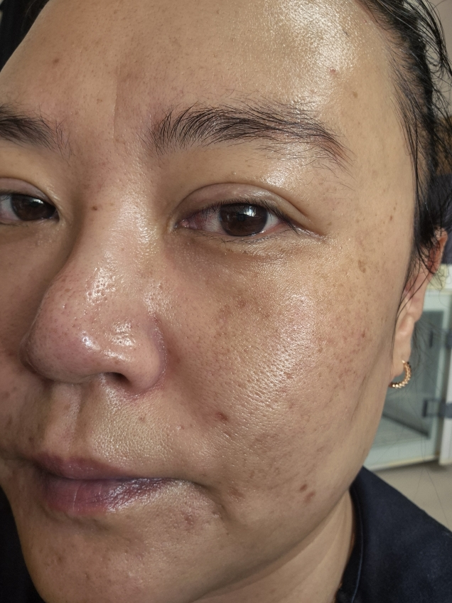 더마팩토리 (DERMAFACTORY) PDRN 4% 앰플 review image