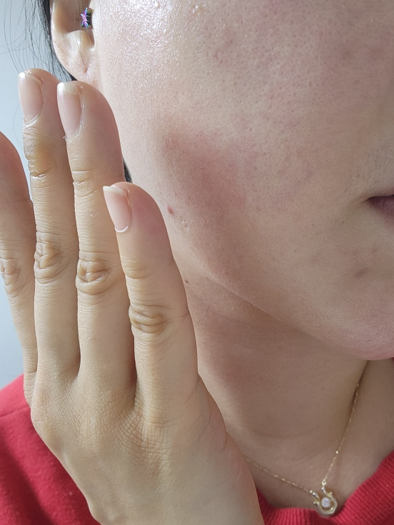 阿朱伦水润精华 [SPF50+/PA+++]的真实用户使用照片