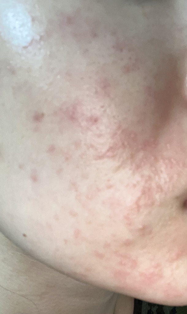 셀퓨전씨 (CellFusionC) 레이저 리쥬버네이션 크림 review image