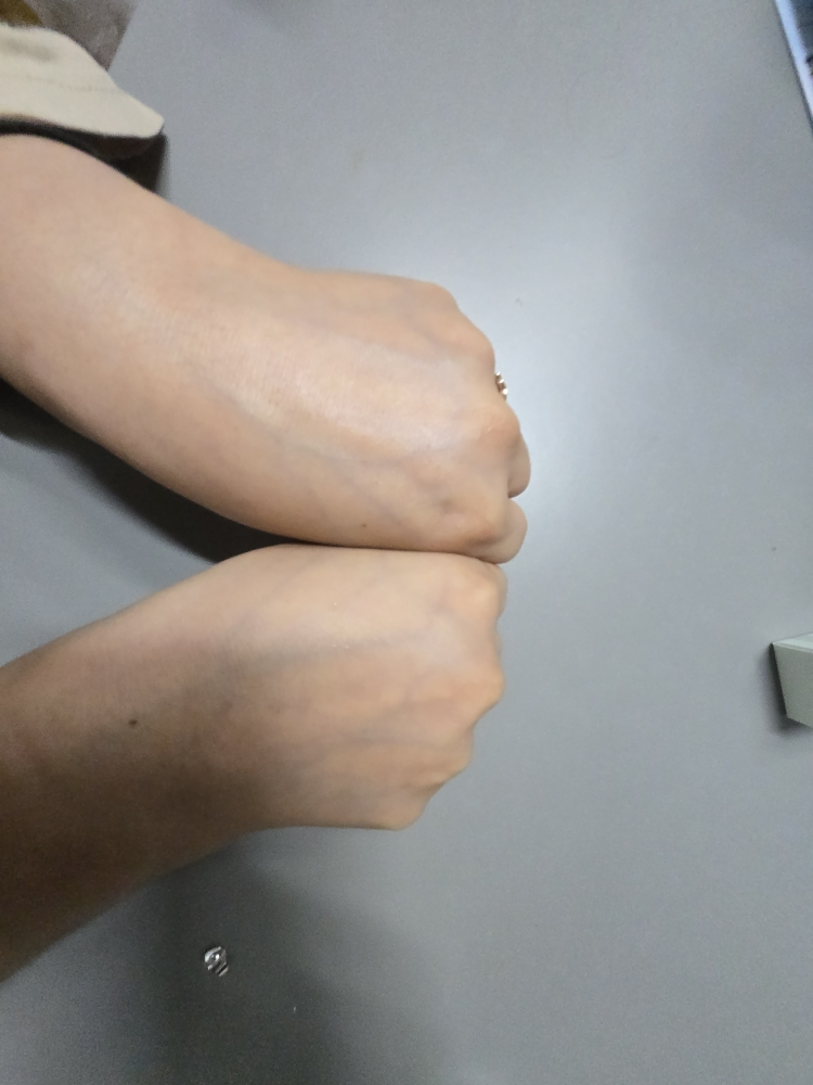 积雪草膏的真实用户使用照片