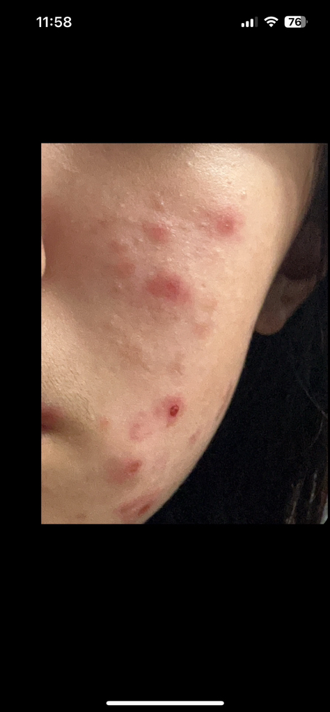 碧缓 阻隔循环碳粉垫 common.review image