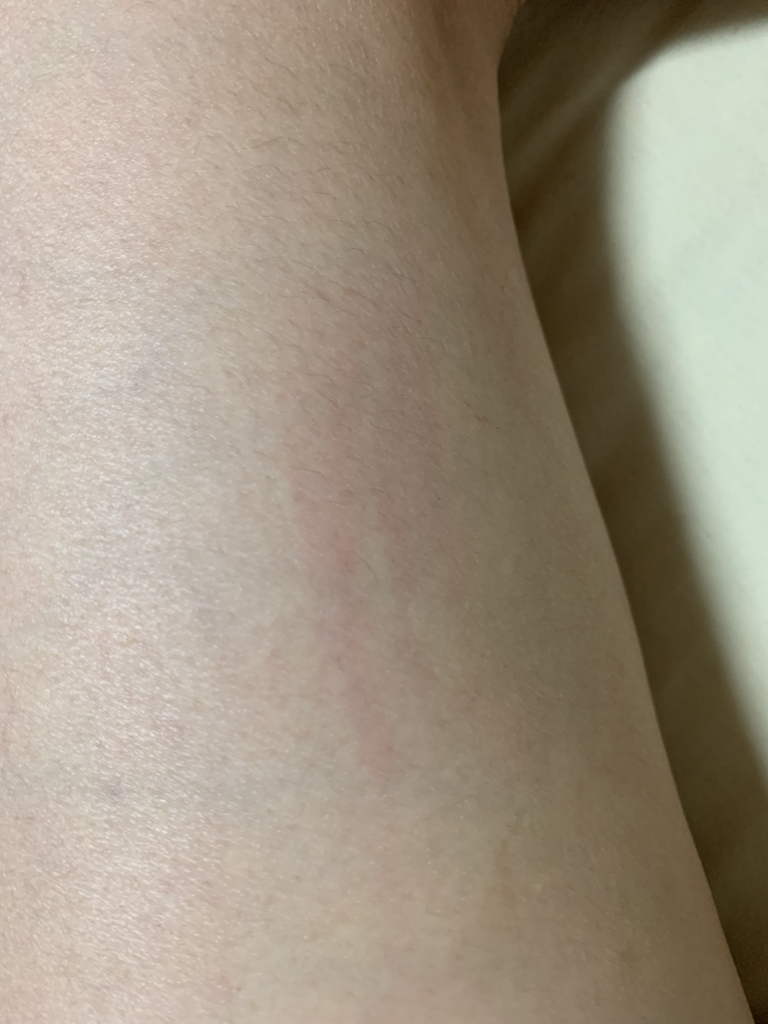 积雪草膏的真实用户使用照片