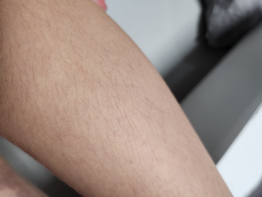 아토팜 (ATOPALM) MLE 크림 review image