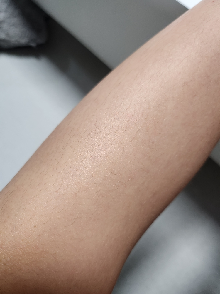 아토팜 (ATOPALM) MLE 크림 review image