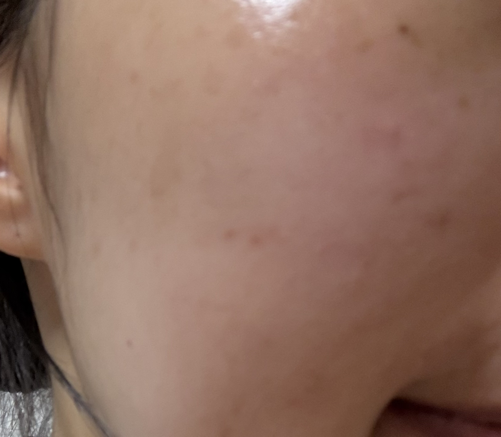 Ảnh đánh giá thực tế của người dùng về Mặt nạ bong bóng nhanh 30 giây [Moist]