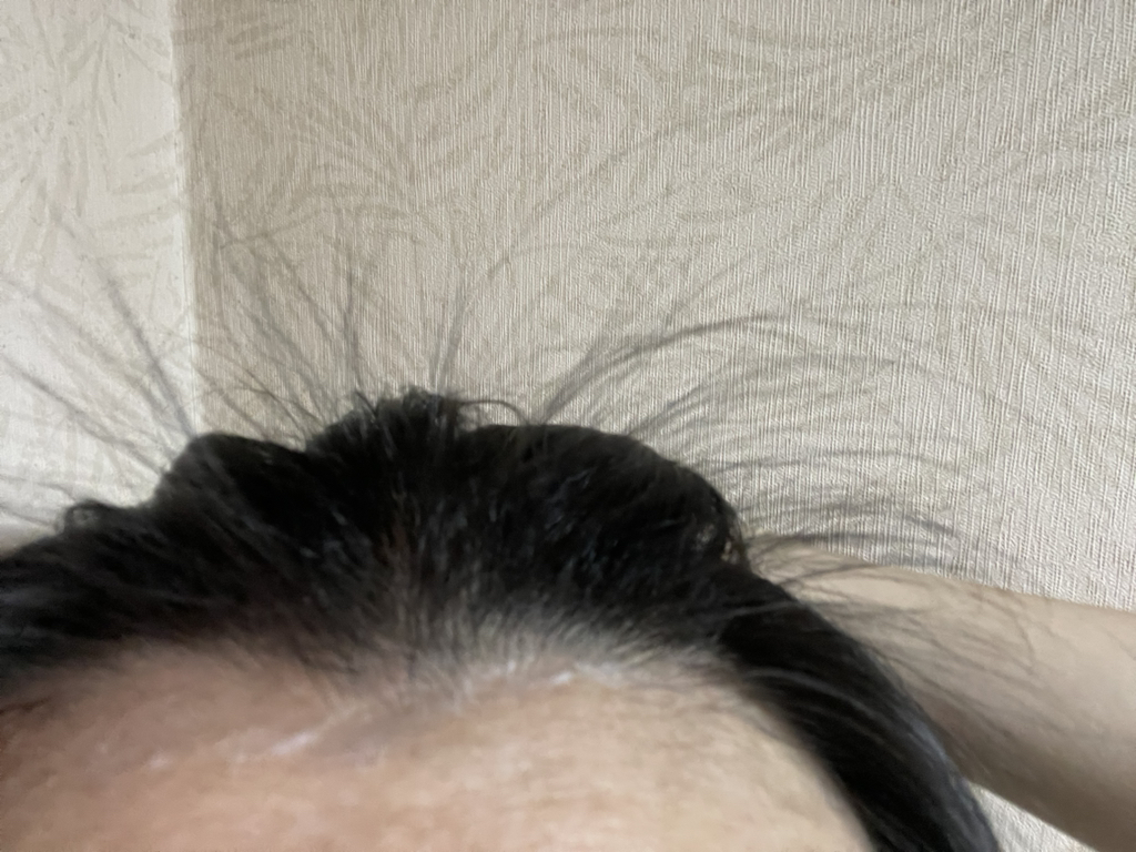 려 (Ryo) 루트젠 탈모증상전문케어 두피에센스 review image