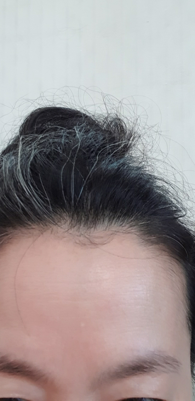 皮肤屏障迷彩乳液的真实用户使用照片