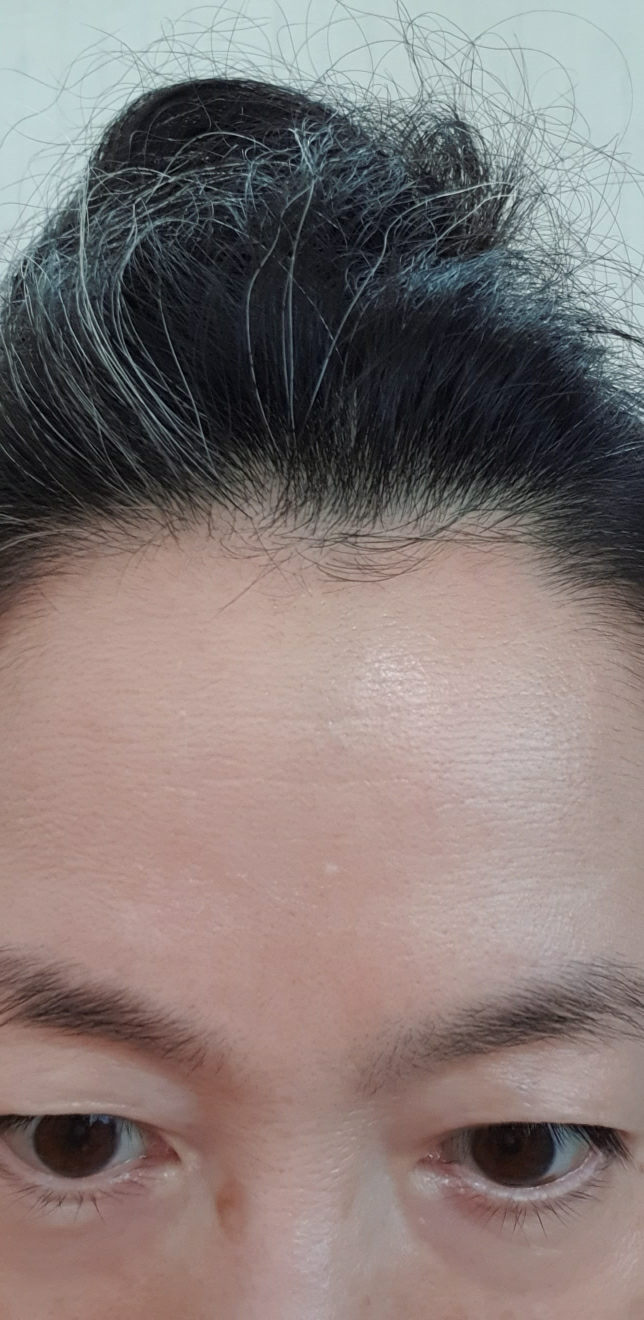 皮肤屏障迷彩乳液的真实用户使用照片