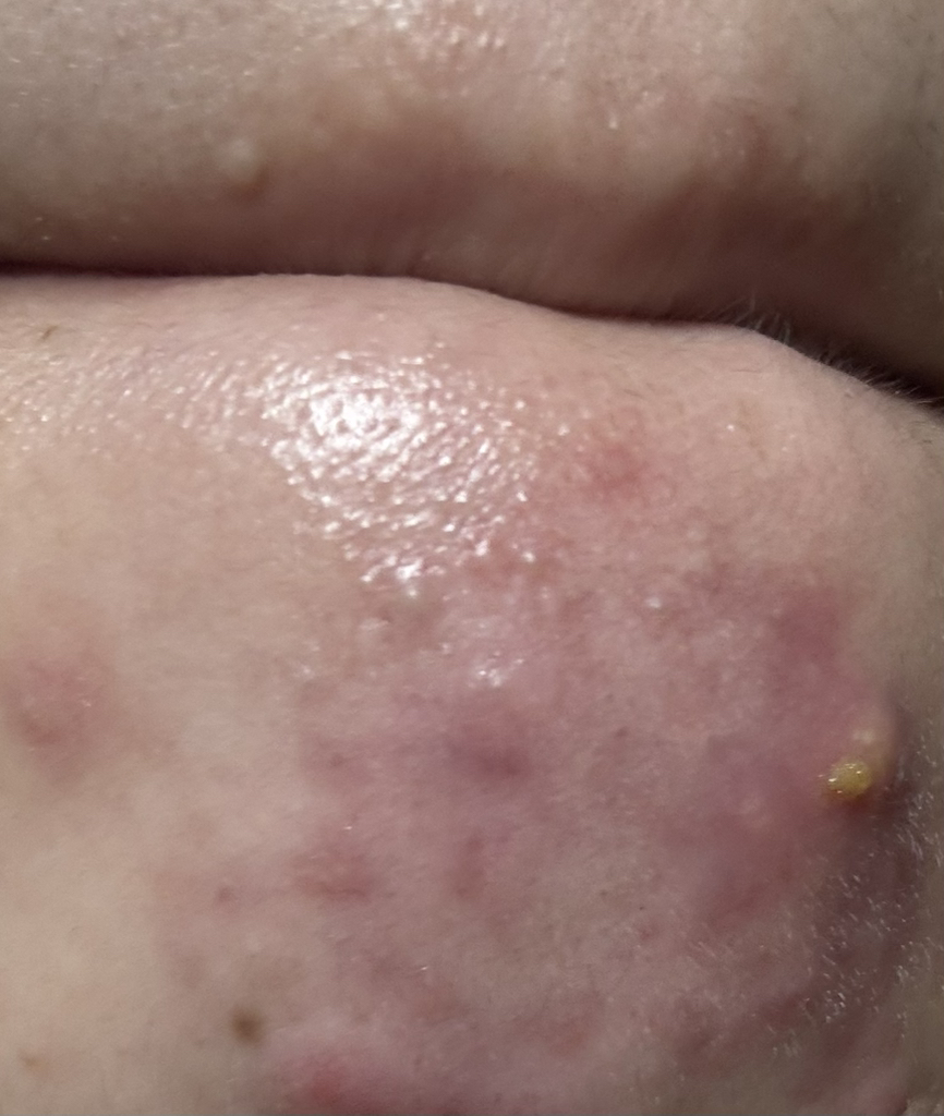 重新平衡故障段 131 安瓿瓶的真实用户使用照片